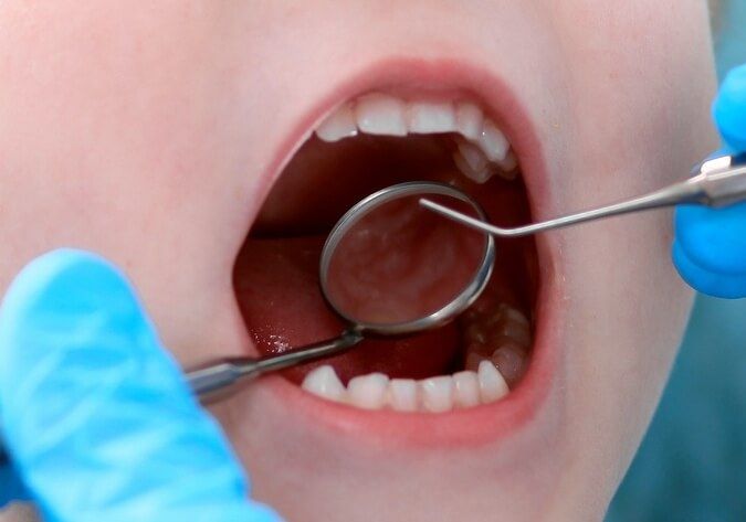 Детский ортодонт