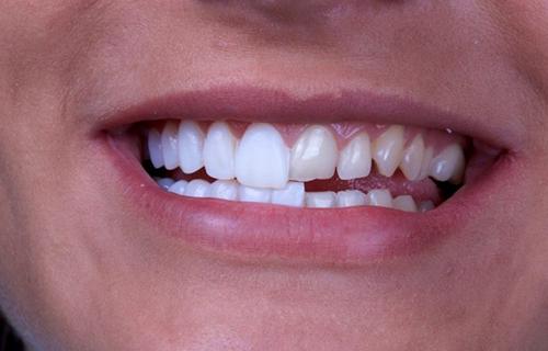 Стоматология: путь к идеальным зубам