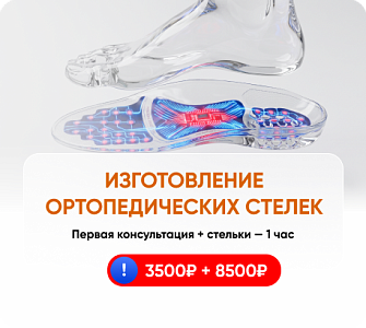 Изготовление ортопедических стелек в Бэби Плюc