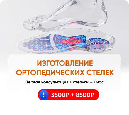 Изготовление ортопедических стелек в Бэби Плюc