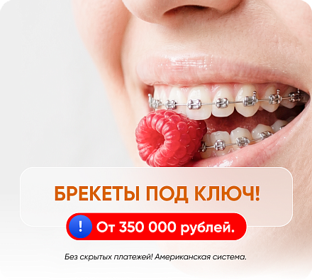 Снижение цен на выравнивание зубов брекет-системами