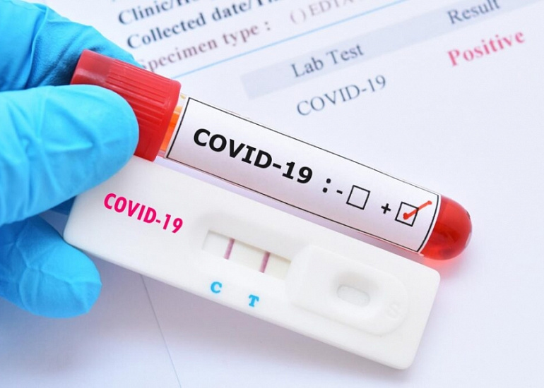 Чем отличается ПЦР-тест на COVID и анализ на антитела