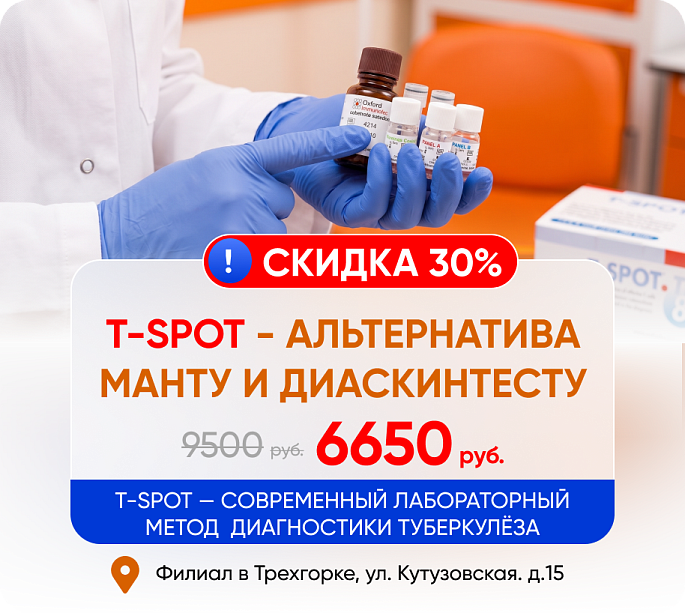 Скидка 30% на T-SPOT! 
