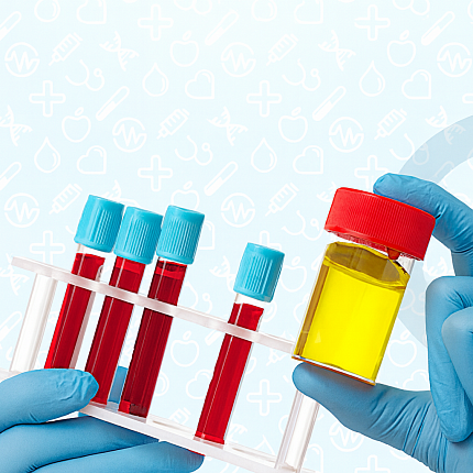 Кешбэк 10% за анализы при сумме чека от 4000 ₽ — в любой день недели!